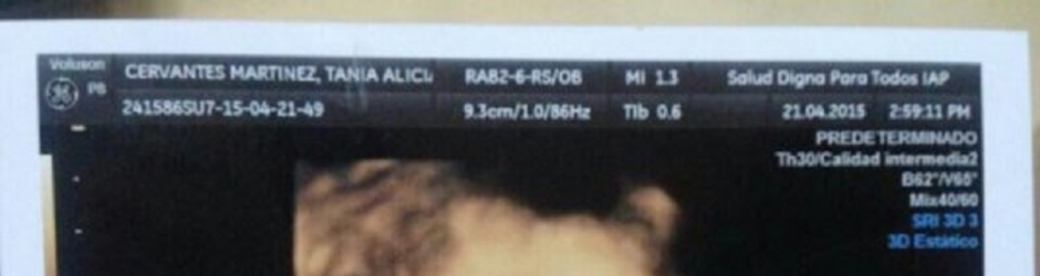 RADEMAKER SILVA BENITEZ