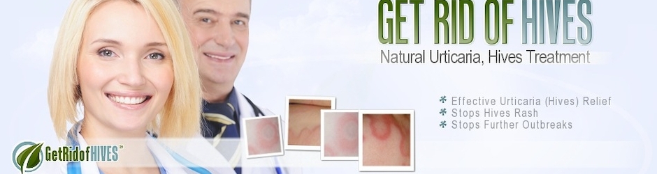 Get rid of hives