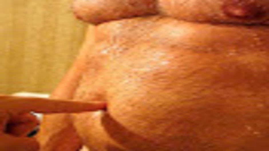 Belly Button Nombril