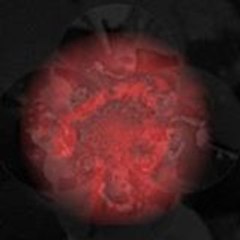 (Alexandre) - (Benjamin)