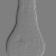 Apolion von Vermis Kalabbaze