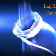 Lap Band Surgery