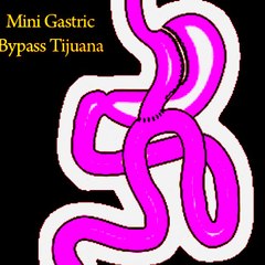 Minibypass Tijuana