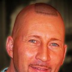 Franck Combet