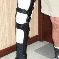 advanced orthoca