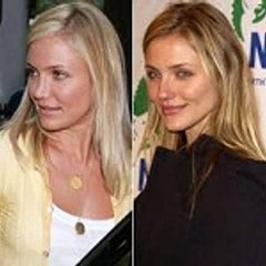 Cameron Diaz Plastic Surgery