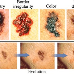 Dermatologist Fort Lauderdale