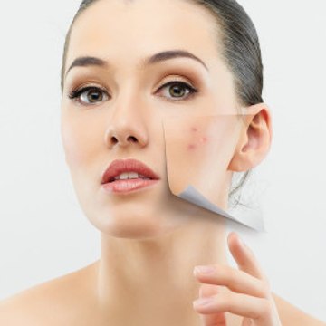 acne no more review