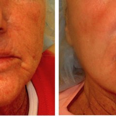 Dermatologist Boca Raton