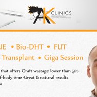 AKClinics - Hair Transplant in India