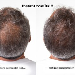 Hair Regrowth Cure
