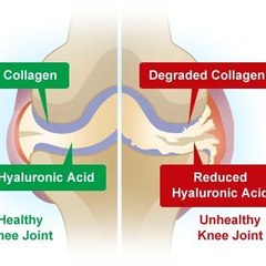 Collagen For Wrinkles
