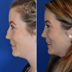 Plastic & Cosmetic Surgery Videos