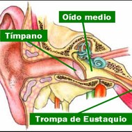 tumores cerebrales