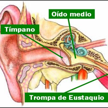 tumores cerebrales