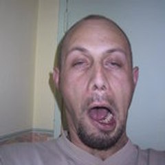 Benoist rod