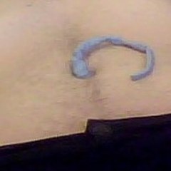 Navel Bugged