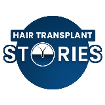 Hair Transplant Stories