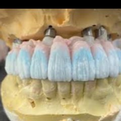 Dental vedio