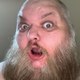 King Beard X