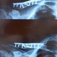 yougo Yougo Traqueurs