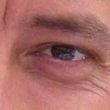 Fabrice Poiraud-Lambert