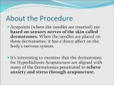 Acupuncture for Hyperhidrosis