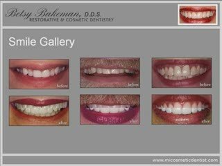 Micosmetic Dentist - Restorative & Cosmetic Dentistry, ...