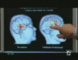 El cerebro del musico: RMf (Jesus Pujol y Carles Soriano)