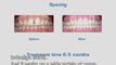 Teeth straightening- nearly invisible braces from Invisalign