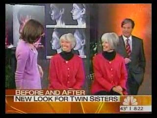 Dr. Antell explains aging in twins on the Today show.