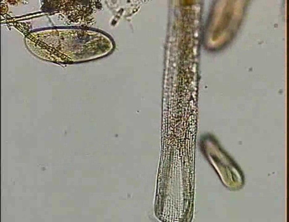 SPIROSTOMUM CAUDATAM