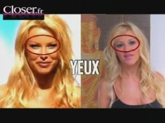 Angie, au moins 4 opérations de chirurgie esthétique en 2ans