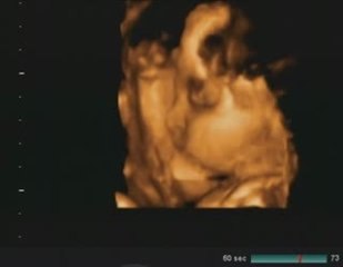 /Volumes/My Passport