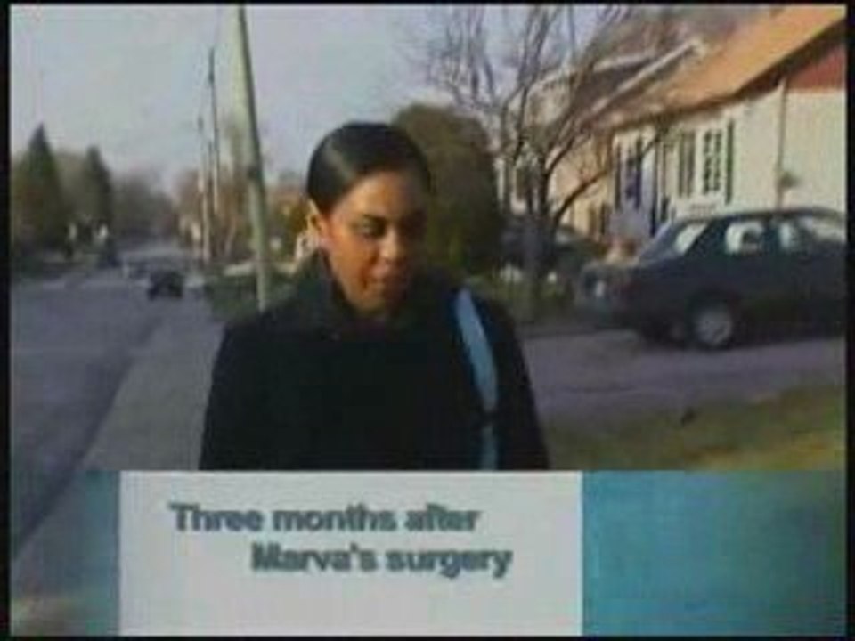 Liposuction Specialist Toronto