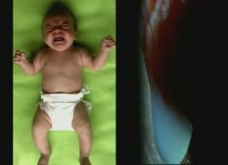 Bebes desvalidos: Desarrollo motor