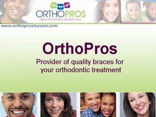 Tucson Invisalign Braces Benefits