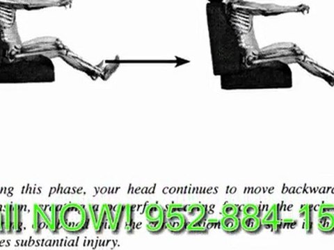 Nonpareil Minneapolis Chiropractor: Car Accident Relief