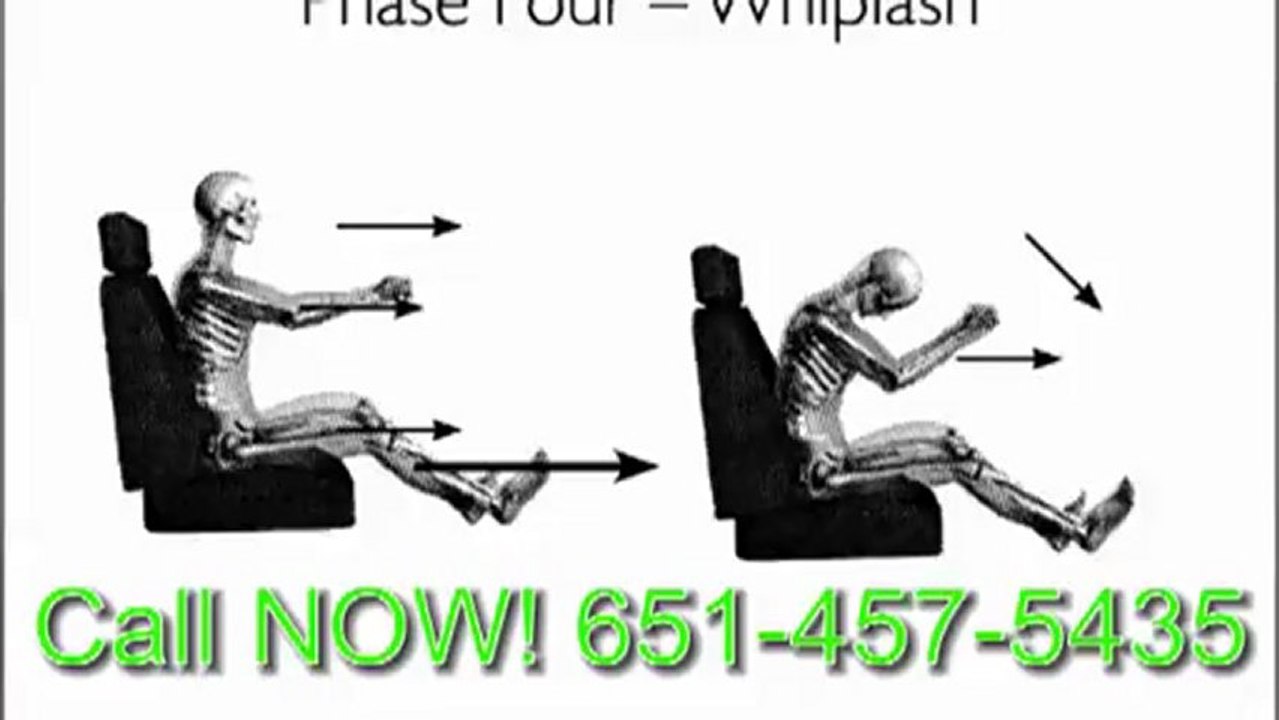 Finest Twin Cities Chiropractic: Numbness Relief