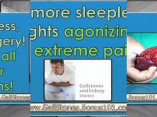natural remedies for gallstones - home remedies for gallstones - gallstones diet