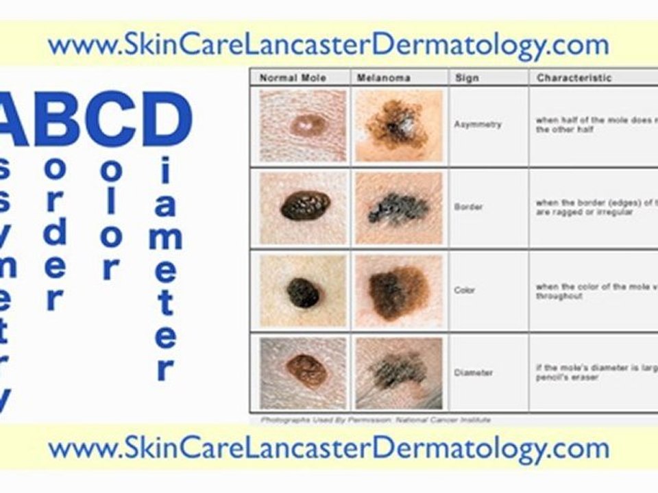 Dermatologists in Lancaster PA - Dermatologists Lancaster PA