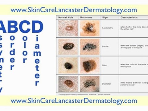Dermatologists in Lancaster PA - Dermatologists Lancaster PA