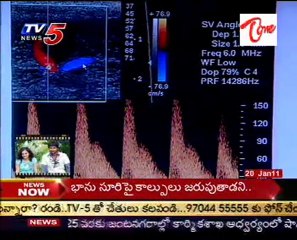 Sparsha - The Touch - Sex Problems & Advises by Dr. Kammela Sridhar - 02