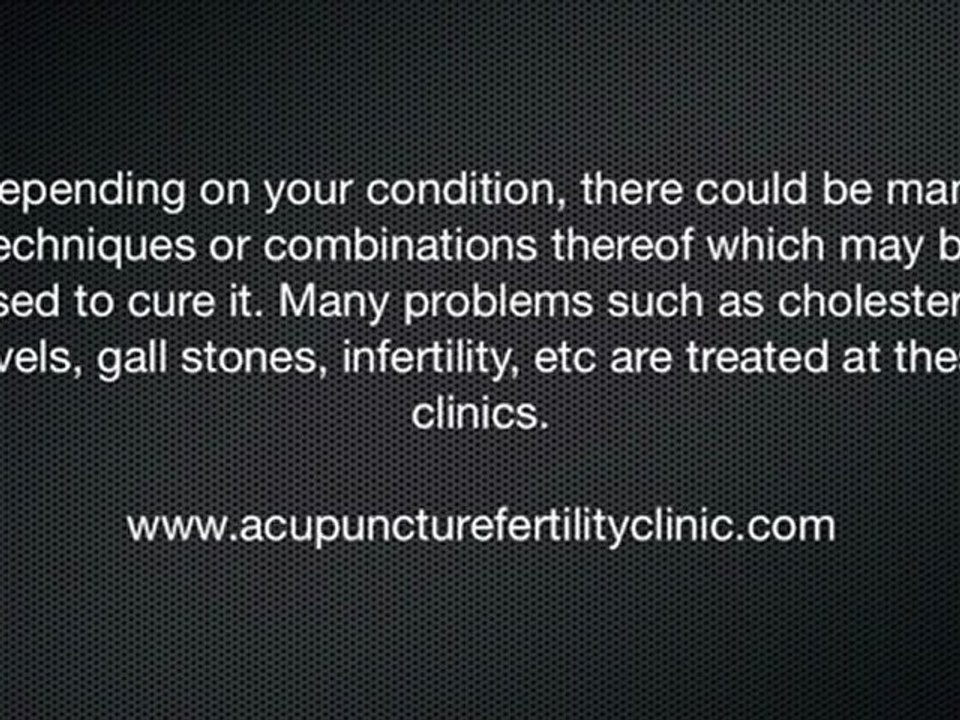 Arlington Acupuncture | Information About Arlington Acupuncture Clinics