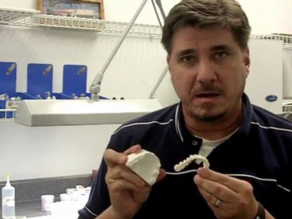 Snap on Smile, Great Alternative to Porcelain Dental Veneers