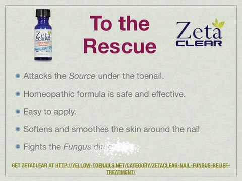 Zetaclear Nail Fungus Relief Consumer Review