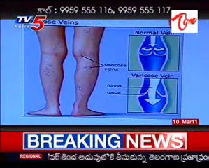 Sparsha - The Touch - Sex Problems & Advises by Dr. Kammela Sridhar - 01