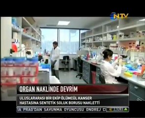 İlk yapay organ nakli yapıldı