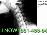 Capital Mendota Heights Chiropractic: Back Pain Relief