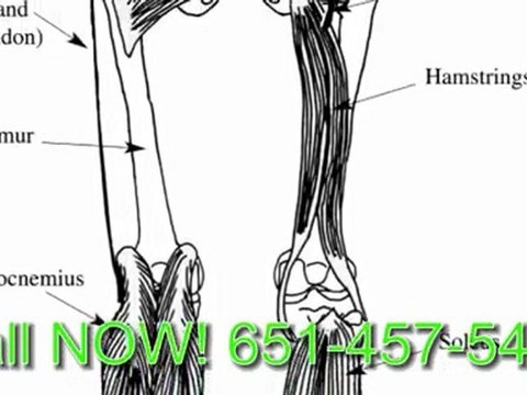 Paramount Saint Paul Chiropractic: Lower Back Ache Relief